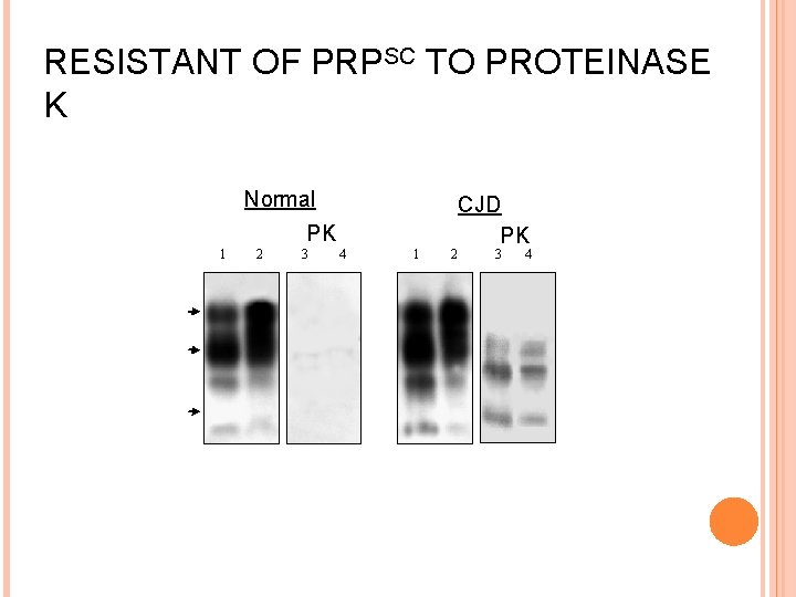 RESISTANT OF PRPSC TO PROTEINASE K Normal PK 1 2 3 4 1 2