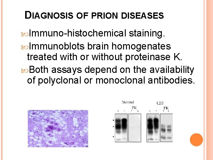 DIAGNOSIS OF PRION DISEASES Immuno-histochemical staining. Immunoblots brain homogenates treated with or without proteinase