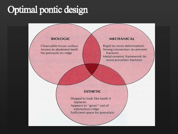 Optimal pontic design 