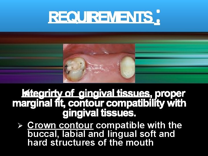 Ø Crown contour compatible with the buccal, labial and lingual soft and hard structures