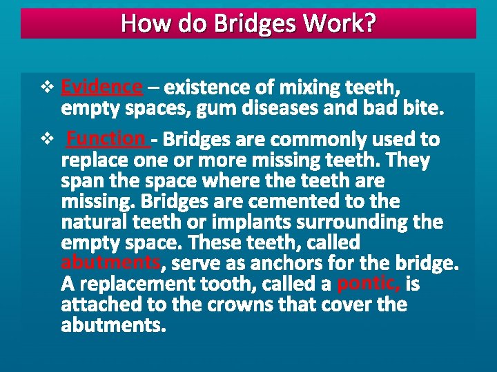 How do Bridges Work? v Evidence v Function abutments pontic, 