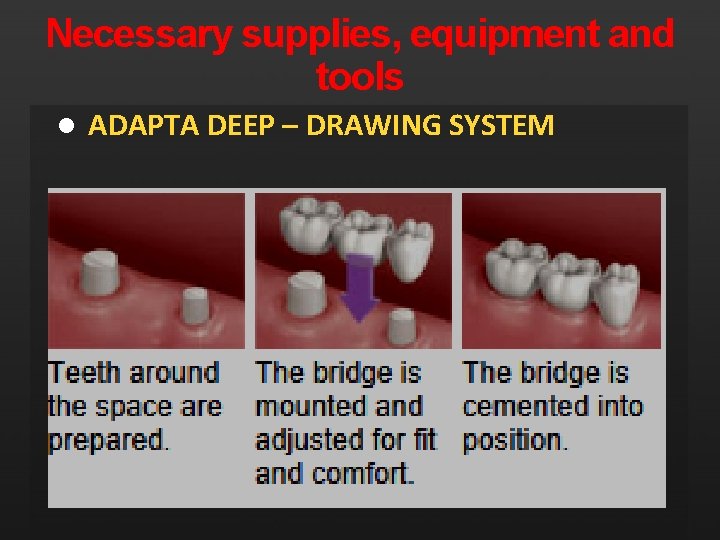 Necessary supplies, equipment and tools l ADAPTA DEEP – DRAWING SYSTEM 