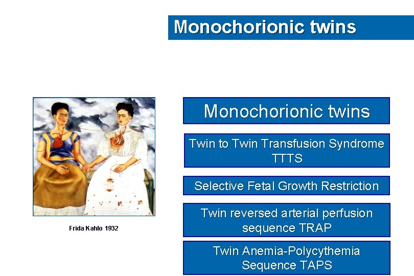 Monochorionic twins Twin to Twin Transfusion Syndrome TTTS Selective Fetal Growth Restriction Frida Kahlo
