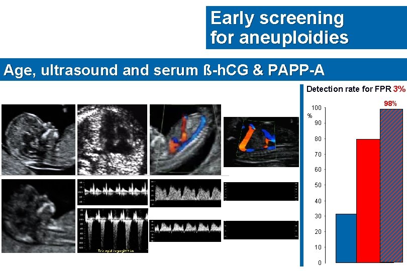Early screening for aneuploidies Age, ultrasound and serum ß-h. CG & PAPP-A Detection rate
