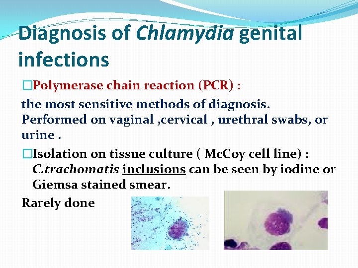 Diagnosis of Chlamydia genital infections �Polymerase chain reaction (PCR) : the most sensitive methods