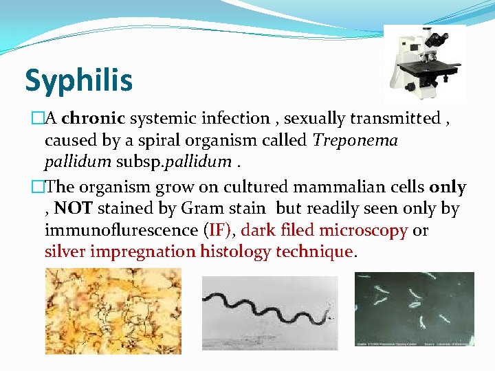 Syphilis �A chronic systemic infection , sexually transmitted , caused by a spiral organism Syphilis �A chronic systemic infection , sexually transmitted , caused by a spiral organism