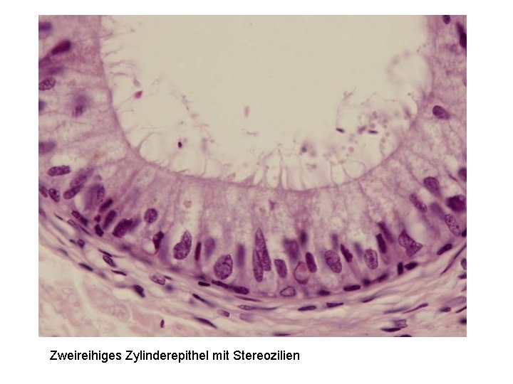 Zweireihiges Zylinderepithel mit Stereozilien 