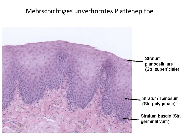 Mehrschichtiges unverhorntes Plattenepithel Stratum planocellulare (Str. superficiale) Stratum spinosum (Str. polygonale) Stratum basale (Str.