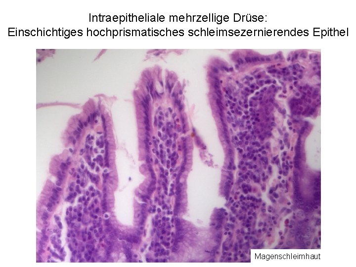 Intraepitheliale mehrzellige Drüse: Einschichtiges hochprismatisches schleimsezernierendes Epithel Magenschleimhaut 