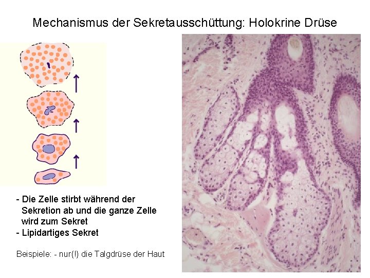 Mechanismus der Sekretausschüttung: Holokrine Drüse - Die Zelle stirbt während der Sekretion ab und