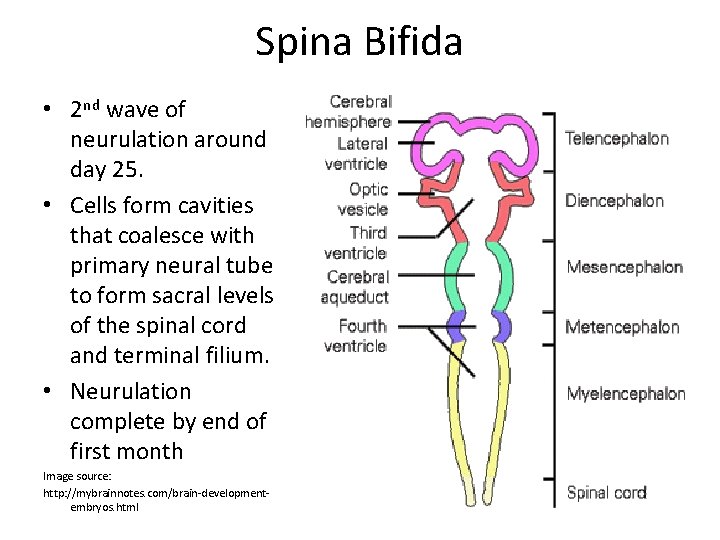 Spina Bifida • 2 nd wave of neurulation around day 25. • Cells form