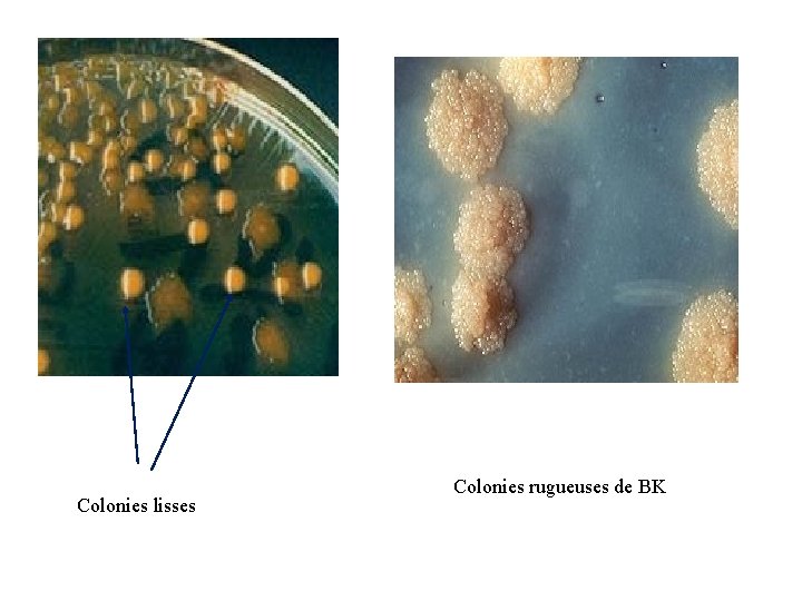 Colonies lisses Colonies rugueuses de BK 
