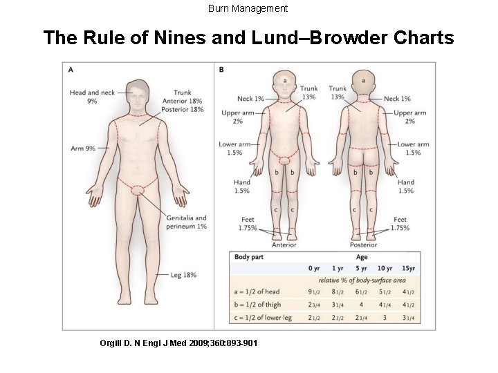 Burn Management The Rule of Nines and Lund–Browder Charts Orgill D. N Engl J