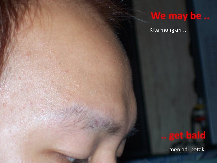 We may be. . Kita mungkin. . get bald. . menjadi botak 