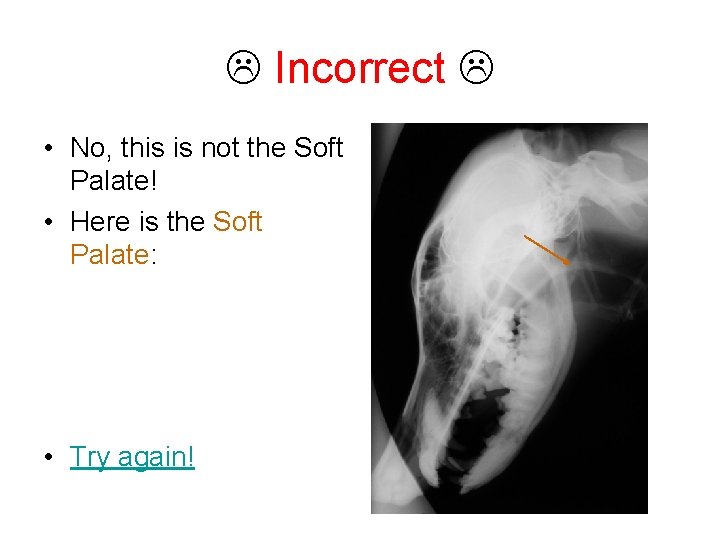  Incorrect • No, this is not the Soft Palate! • Here is the