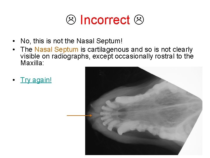  Incorrect • No, this is not the Nasal Septum! • The Nasal Septum