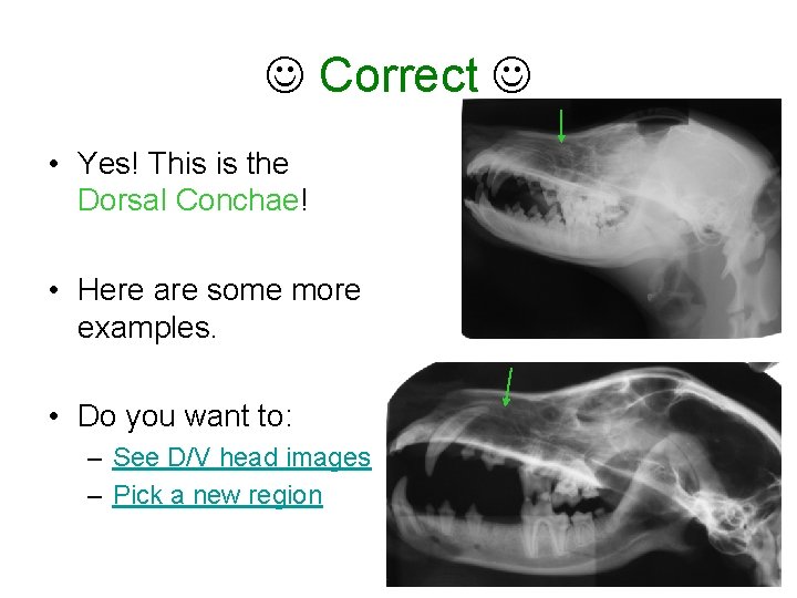  Correct • Yes! This is the Dorsal Conchae! • Here are some more