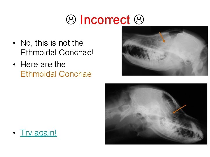  Incorrect • No, this is not the Ethmoidal Conchae! • Here are the