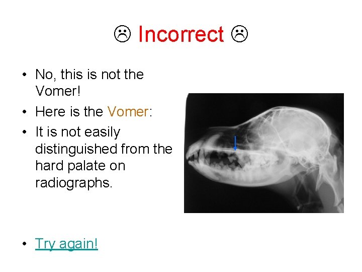  Incorrect • No, this is not the Vomer! • Here is the Vomer: