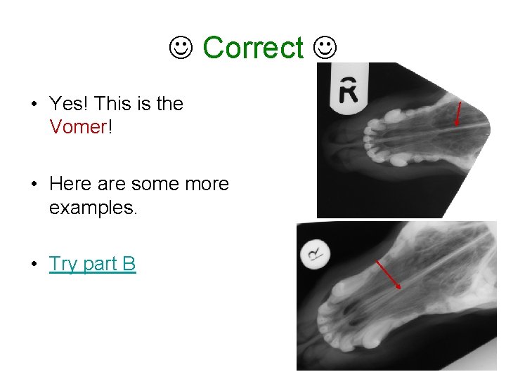  Correct • Yes! This is the Vomer! • Here are some more examples.