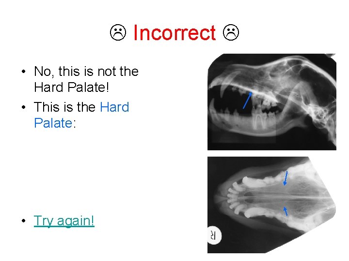  Incorrect • No, this is not the Hard Palate! • This is the