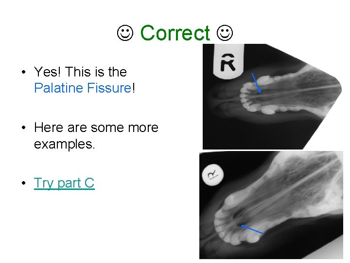  Correct • Yes! This is the Palatine Fissure! • Here are some more