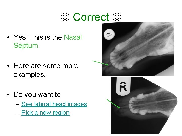  Correct • Yes! This is the Nasal Septum! • Here are some more