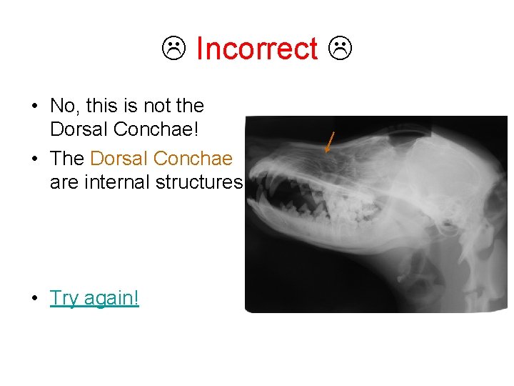  Incorrect • No, this is not the Dorsal Conchae! • The Dorsal Conchae