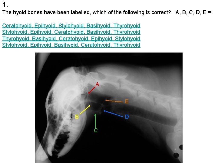 1. The hyoid bones have been labelled, which of the following is correct? A,