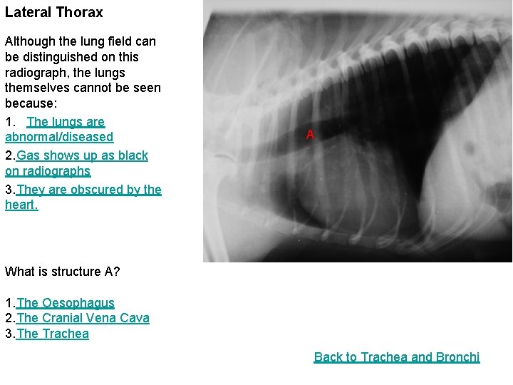 Lateral Thorax Although the lung field can be distinguished on this radiograph, the lungs