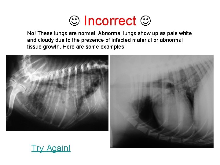  Incorrect No! These lungs are normal. Abnormal lungs show up as pale white