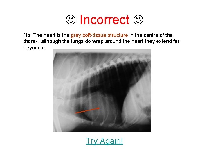  Incorrect No! The heart is the grey soft-tissue structure in the centre of