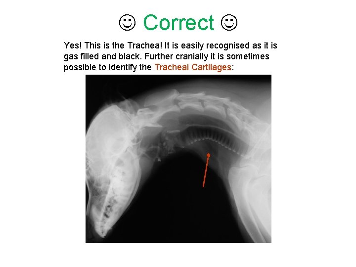  Correct Yes! This is the Trachea! It is easily recognised as it is