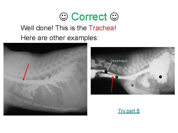  Correct Well done! This is the Trachea! Here are other examples: Oesophagus Try