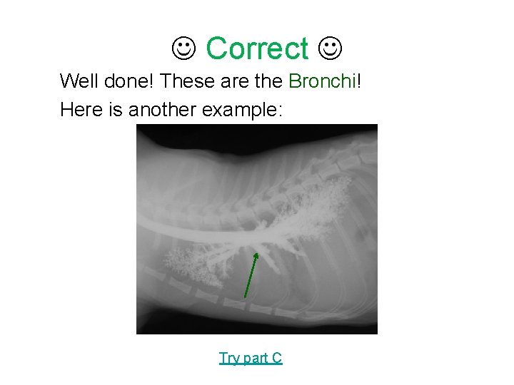  Correct Well done! These are the Bronchi! Here is another example: Try part