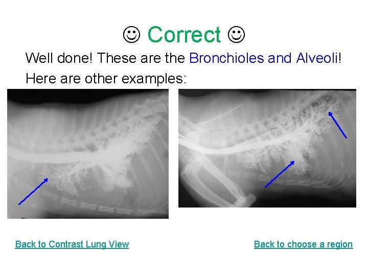  Correct Well done! These are the Bronchioles and Alveoli! Here are other examples: