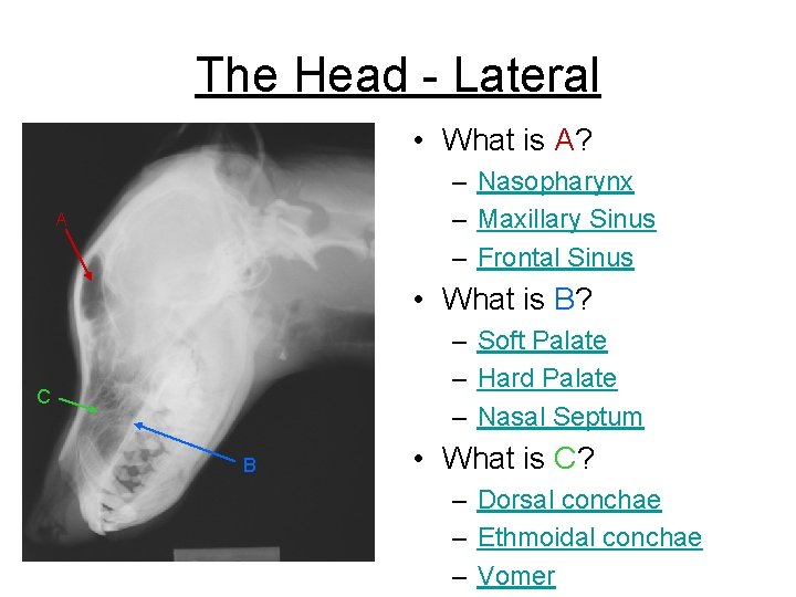 The Head - Lateral • What is A? – Nasopharynx – Maxillary Sinus –