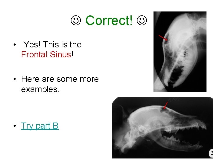  Correct! • Yes! This is the Frontal Sinus! • Here are some more