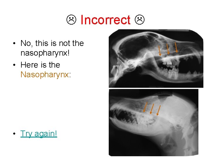  Incorrect • No, this is not the nasopharynx! • Here is the Nasopharynx:
