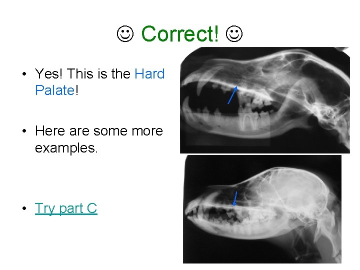  Correct! • Yes! This is the Hard Palate! • Here are some more