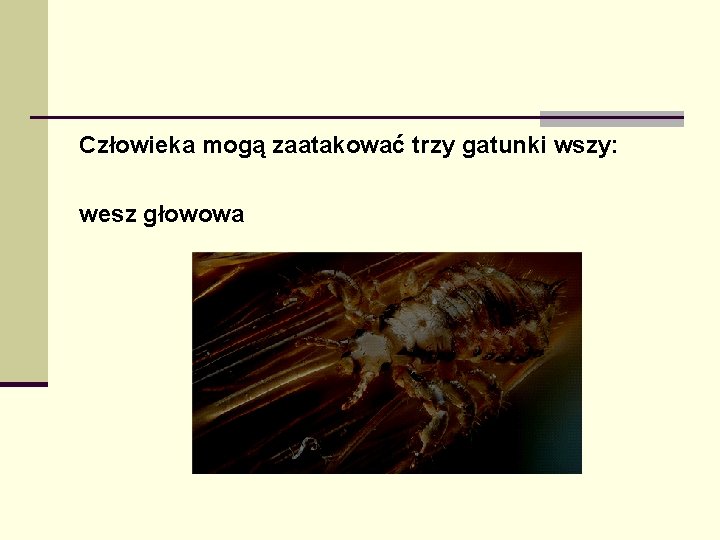 Człowieka mogą zaatakować trzy gatunki wszy: wesz głowowa 