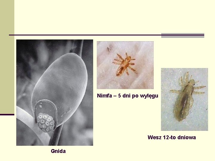 Nimfa – 5 dni po wylęgu Wesz 12 -to dniowa Gnida 