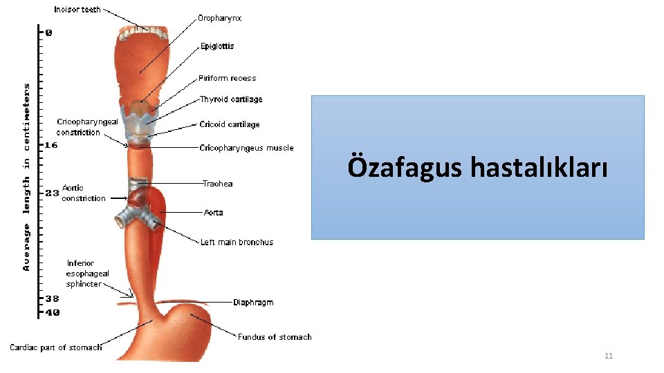 Özafagus hastalıkları 11 