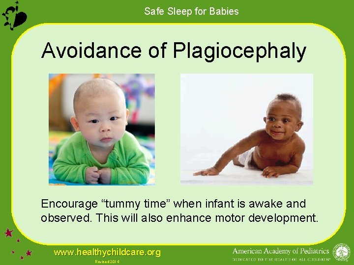 Safe Sleep for Babies Avoidance of Plagiocephaly Encourage “tummy time” when infant is awake