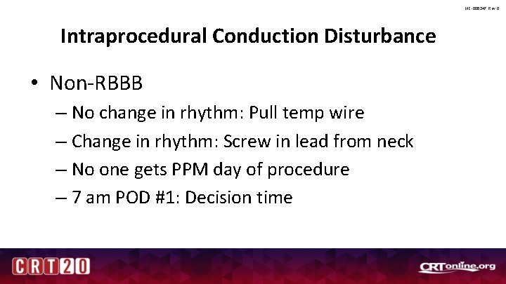 MC-006247 Rev 0 Intraprocedural Conduction Disturbance • Non-RBBB – No change in rhythm: Pull