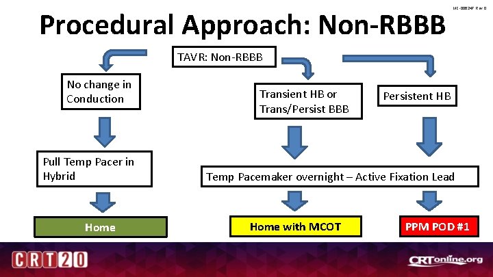 Procedural Approach: Non-RBBB MC-006247 Rev 0 TAVR: Non-RBBB No change in Conduction Pull Temp