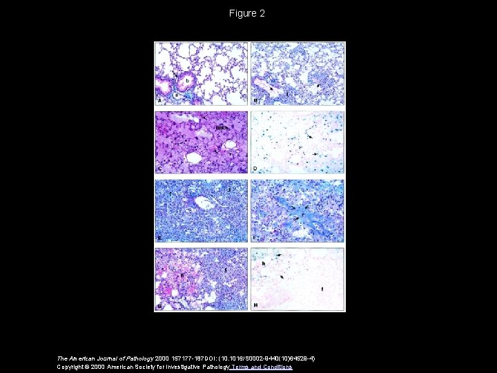 Figure 2 The American Journal of Pathology 2000 157177 -187 DOI: (10. 1016/S 0002