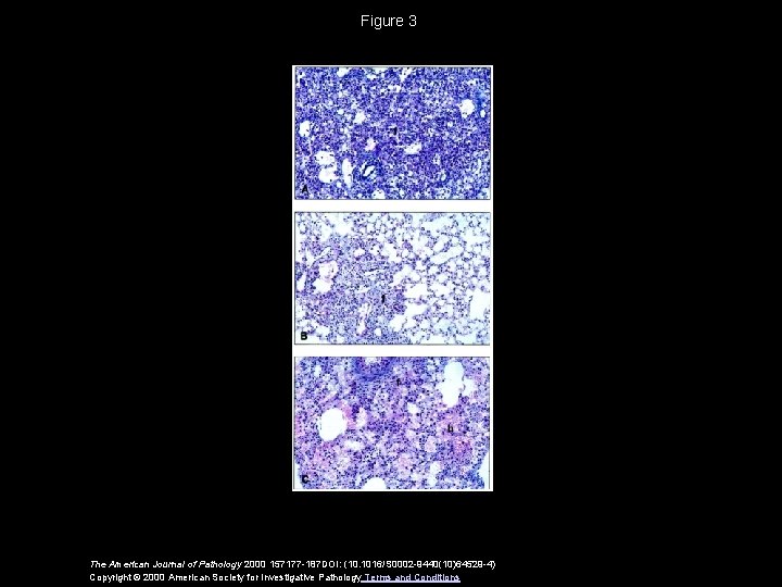 Figure 3 The American Journal of Pathology 2000 157177 -187 DOI: (10. 1016/S 0002