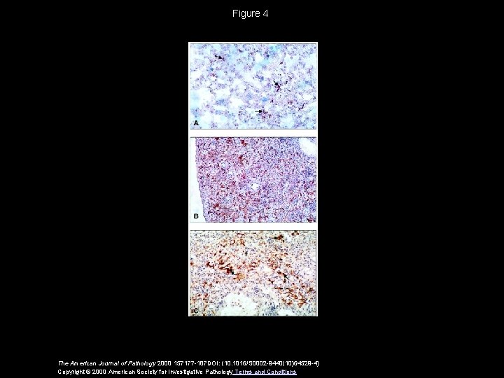 Figure 4 The American Journal of Pathology 2000 157177 -187 DOI: (10. 1016/S 0002