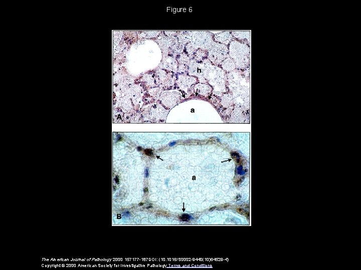 Figure 6 The American Journal of Pathology 2000 157177 -187 DOI: (10. 1016/S 0002